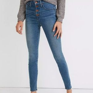 Madewell 10" High-Rise Exposed Button-Fly Edition Ankle Skinny Jeans